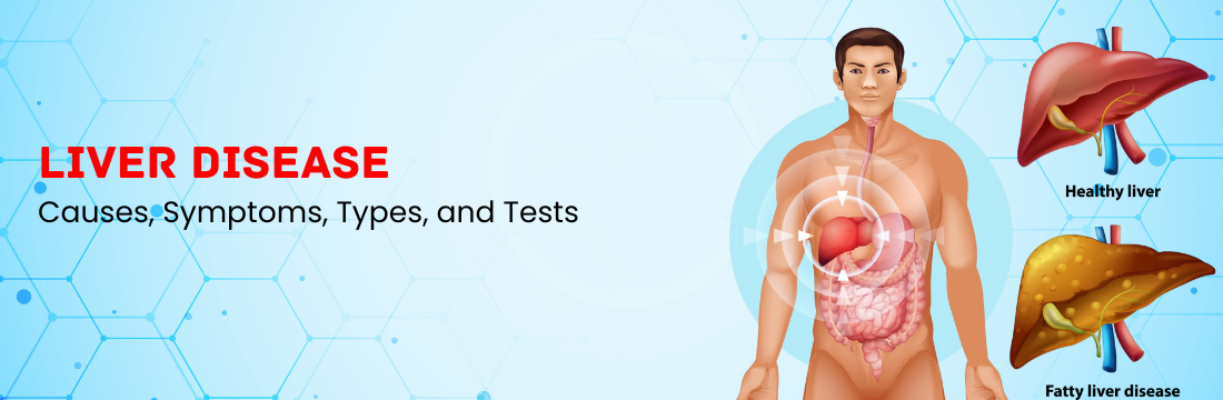 Liver Disease: Causes, Symptoms, Types, and Tests